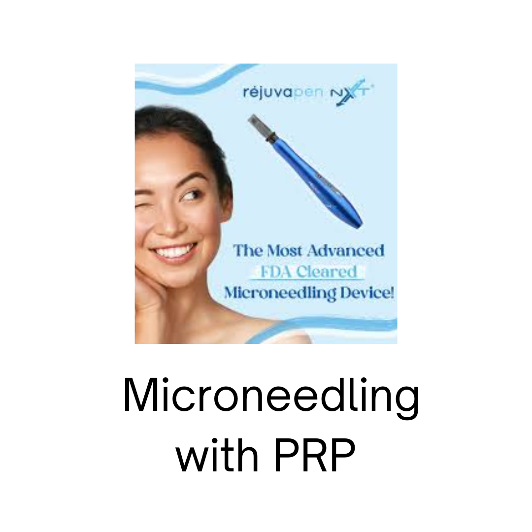 Microneedling with PRP - buy 3, get 1 free