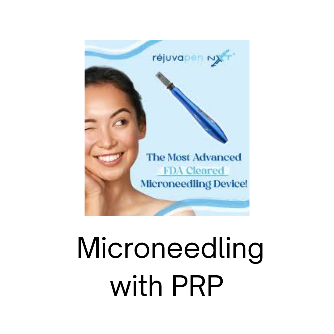 Microneedling with PRP - package of 4 treatments