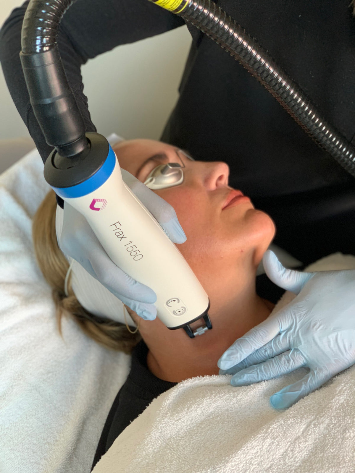 Frax- great for improving texture (crepey skin, wrinkles or acne scarring) buy 3, get 1 free